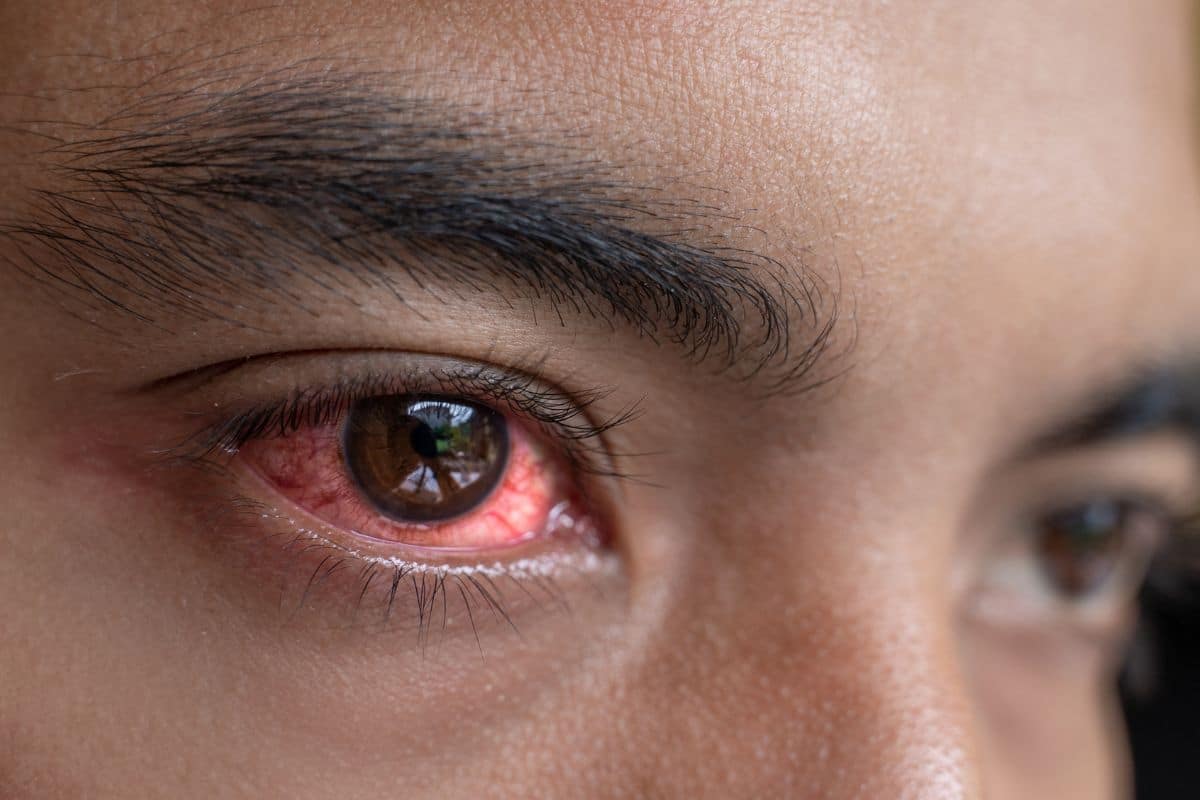 A man's eye exhibiting redness, potentially caused by edibles.