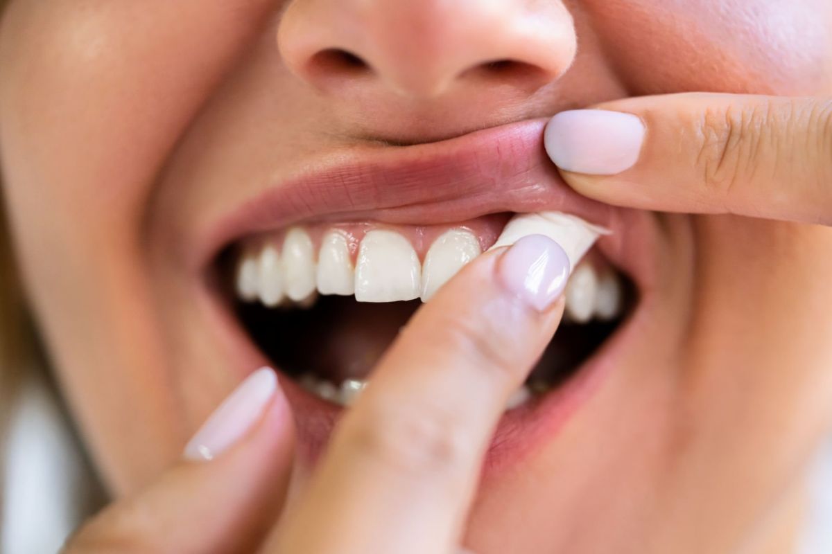 A lady placing zyn nicotine pouch on the upper part of the lips