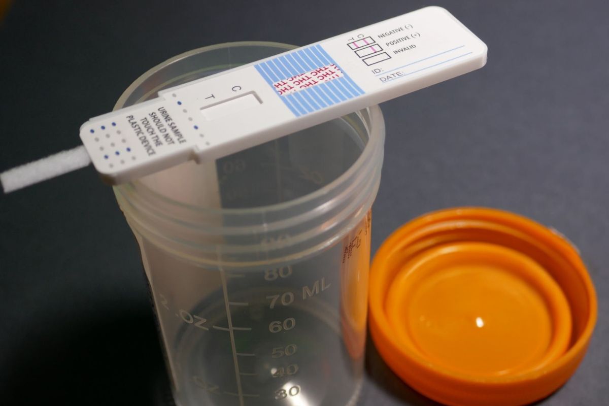 A marijuana urine drug test apparatus is shown in the image