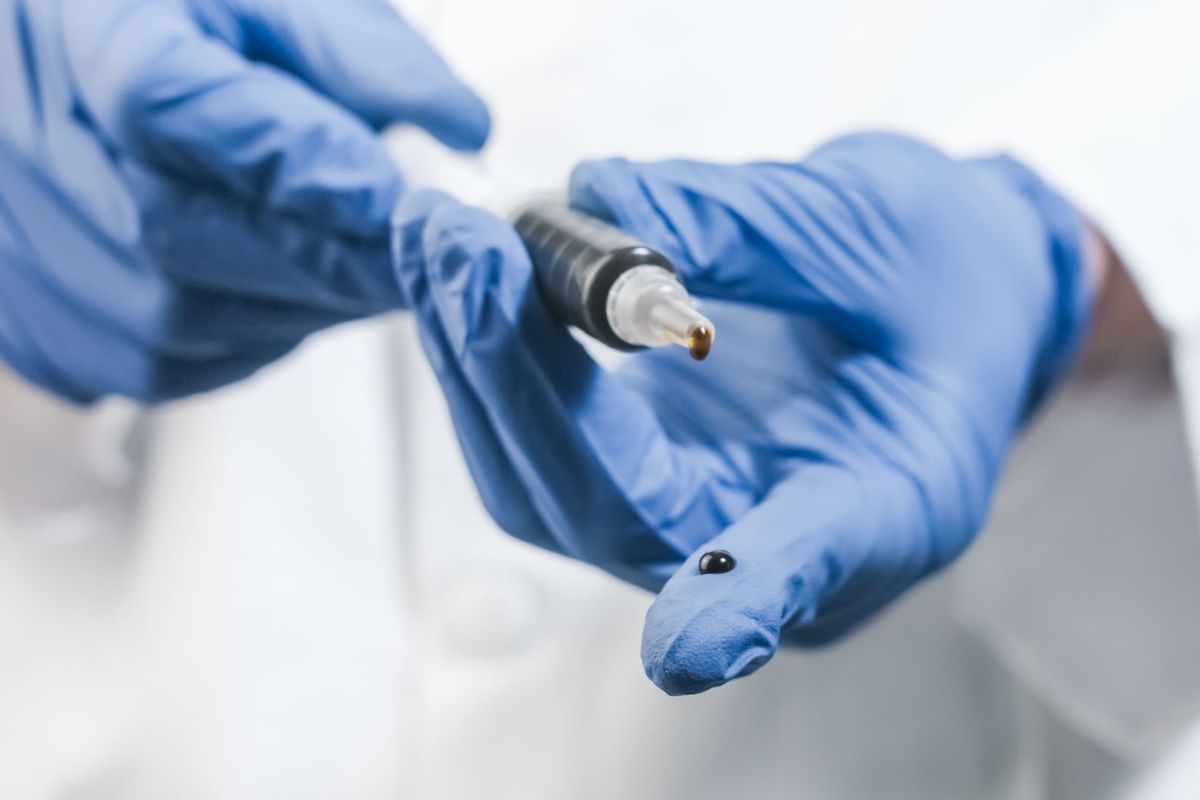 A doctor holding a syringe of RSO to prescribe it to a patient for medical use